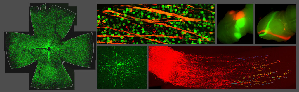 De gauche à droite: Expression transgénique de la protéine fluorescente verte (GFP) dans les cellules ganglionnaires d’une rétine de souris adulte étalée. À plus fort grossissement, marquage immunohistochimique des cellules ganglionnaires de la rétine avec un anticorps dirigé contre la tubuline b 3 (rouge) et après expression transgénique de la GFP. Vue dorsale et ventrale des projections axonales des cellules ganglionnaires de l’œil gauche (rouge) et droit (vert) dans le cerveau. Arbre dendriti