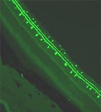 Cette photo  montre une  cellule amacrine de la rétine chez le rat.